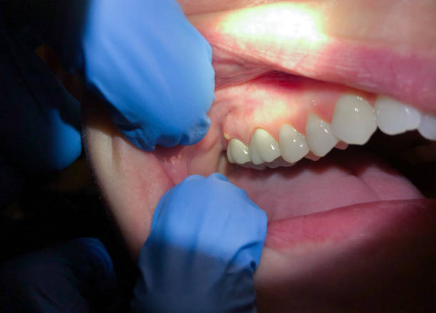 Best Orthodontic Emergency Dentist in Springtown, TX